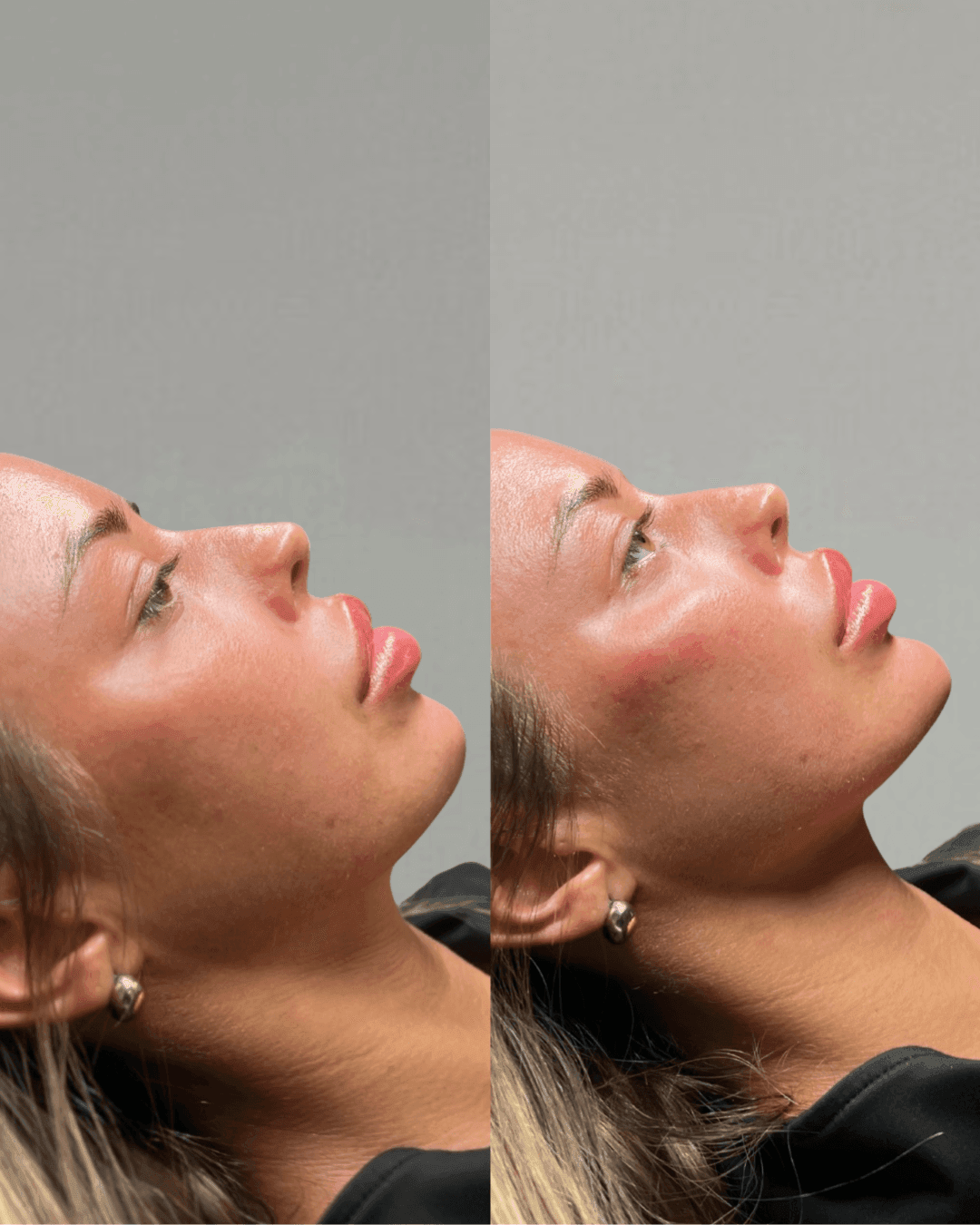 Facial Balancing