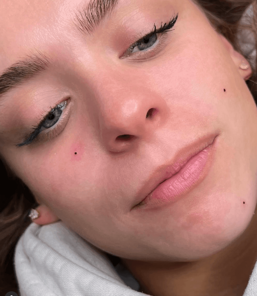 Beauty Spots