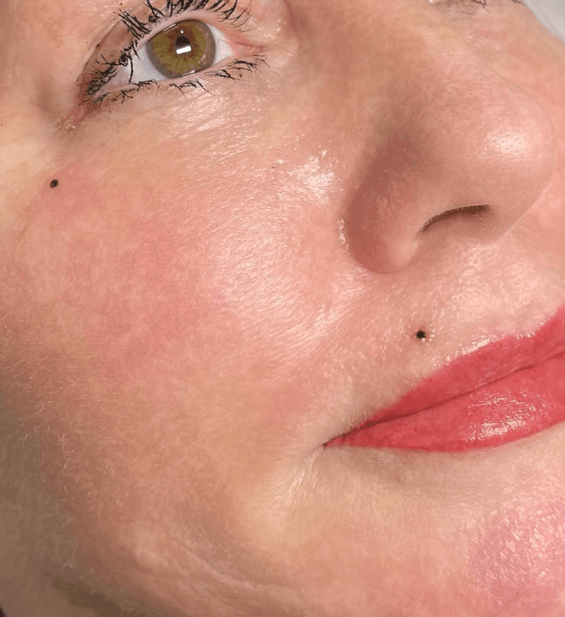 Beauty Spot Top Up